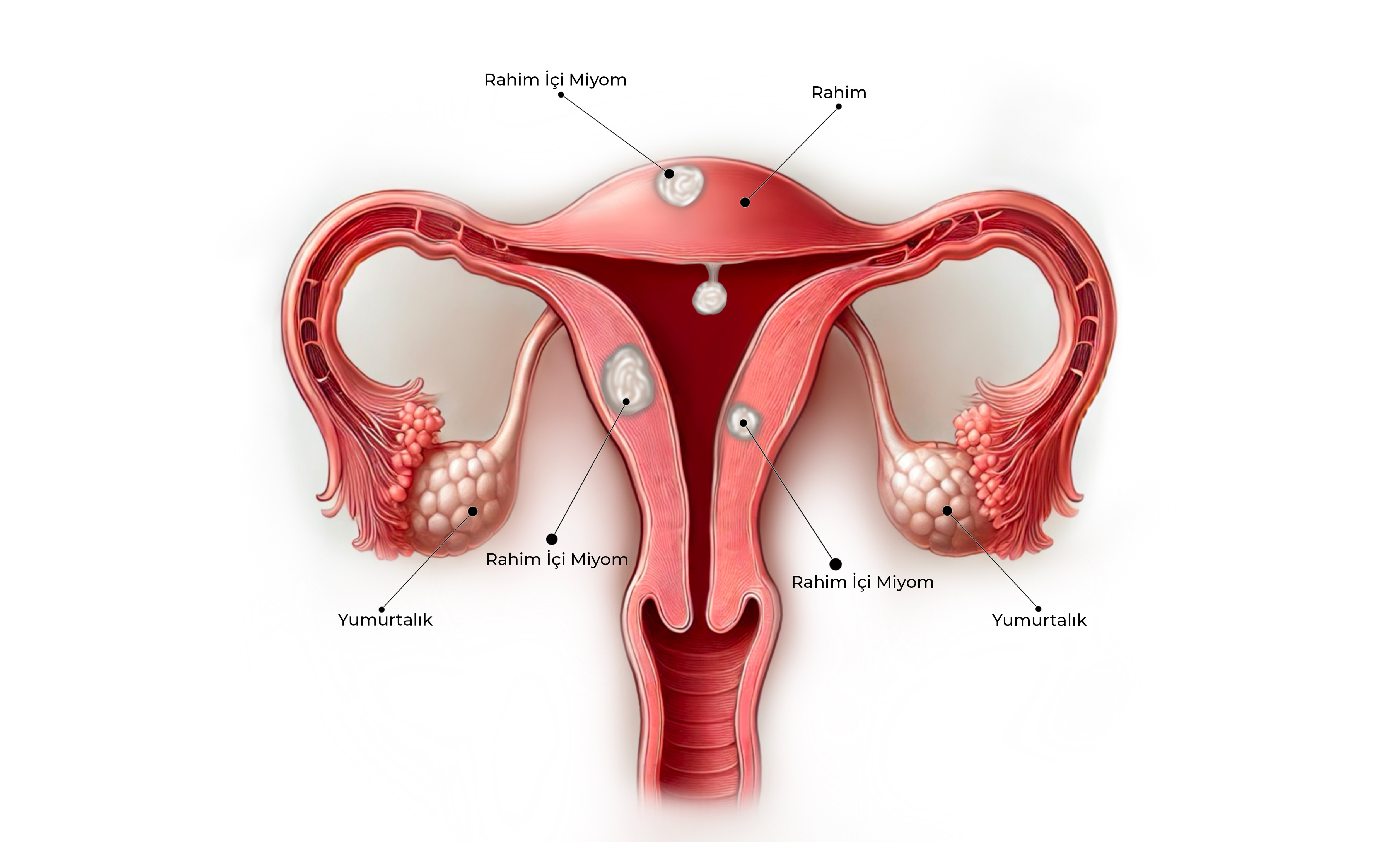 Riskli Gebelik Görseli